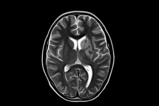 拉文：我很想和詹姆斯 以及一个有统治力的大个子一起打球